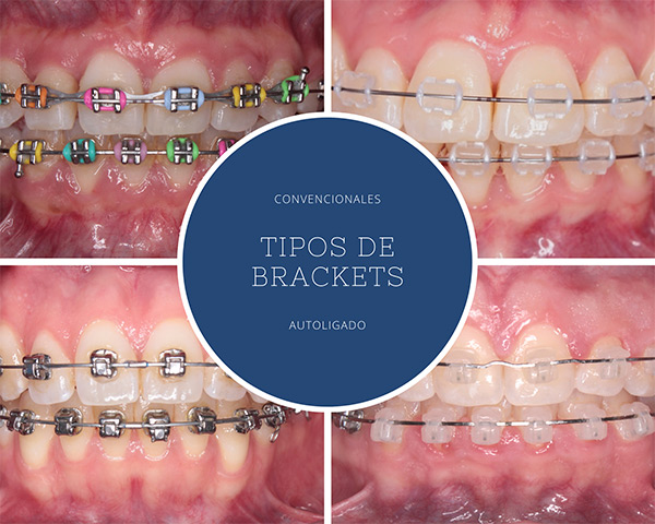 Yamada Viggiano Ortodoncia | Ortodoncia en Pachuca