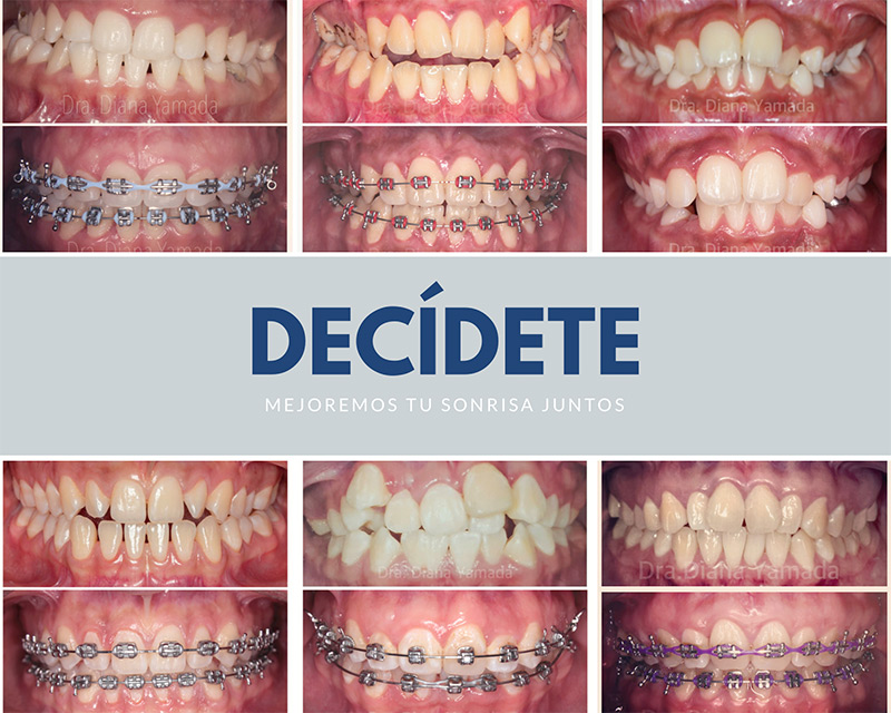 Yamada Viggiano Ortodoncia